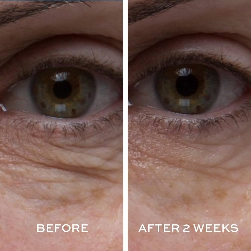 Elemis Peptide4 Eye Recovery Cream - Picture 5 of 10